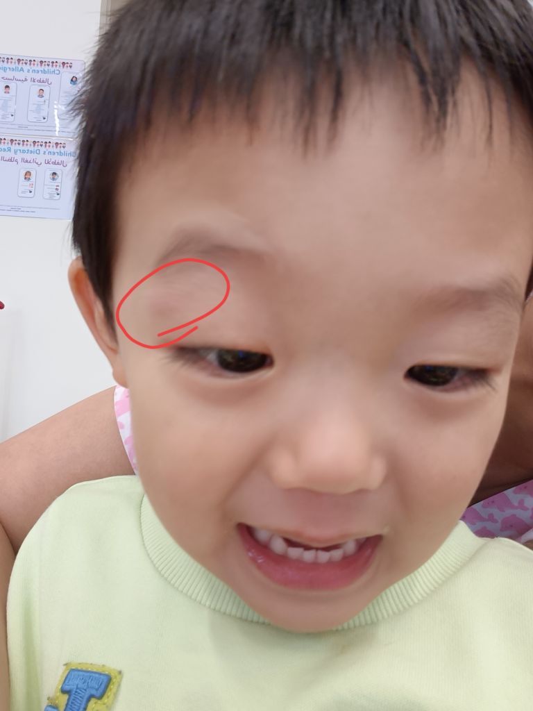 두바이 어린이집 적응기|한 달 3번 부상 후 6개월 만에 웃기까지